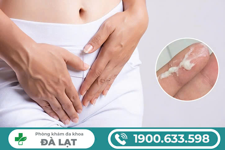 Hình ảnh minh họa